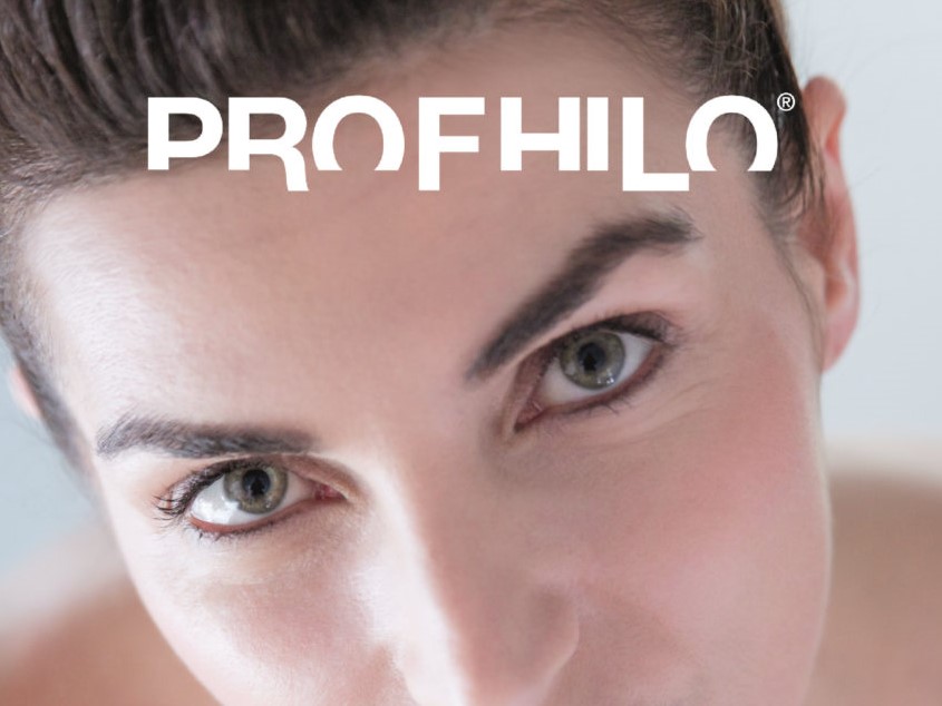Profhilo –  What’s it all About?